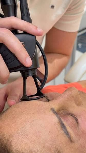 Aplicação facial com Fusion Cromatic